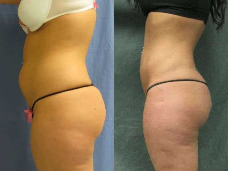 Before and After Results 2